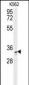 AKR1C3 Antibody (N-term)
